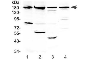Western blot testing of 1) human PANC-1, 2) human placenta, 3) rat kidney and 4) mouse kidney lysate with ERBB4 antibody at 0. (ERBB4 Antikörper)