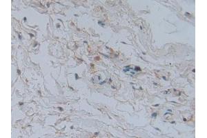 Used in DAB staining on fromalin fixed paraffin-embedded heart tissue