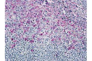Immunohistochemical (Formalin/PFA-fixed paraffin-embedded sections) staining in human tonsil with CCR8 polyclonal antibody . (CCR8 Antikörper  (3rd Cytoplasmic Domain))