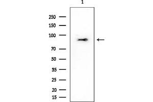 Western blot analysis of lysates from EC304 cells, using SEMA7A Mouse Monoclonal Antibody at 1/1000 dilution.