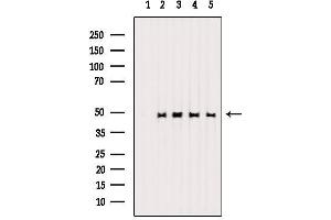Western Blotting (WB) image for anti-Histone Deacetylase 3 (HDAC3) (pSer424) antibody (ABIN6256332)