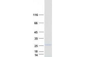 Western Blotting (WB) image for Resistin Like beta (RETNLB) protein (Myc-DYKDDDDK Tag) (ABIN2730706)