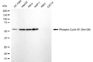 Western blotting analysis using phospho-cyclin B1 (Ser126) antibody (ABIN7798192).