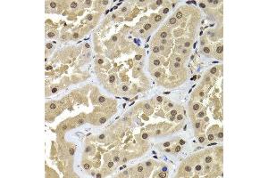 Immunohistochemistry of paraffin-embedded human kidney using ACTL6B antibody at dilution of 1:100 (x400 lens).
