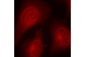 Immunofluorescence (IF) image for anti-Histone Deacetylase 8 (HDAC8) (pSer39) antibody (ABIN1870227) (HDAC8 Antikörper  (pSer39))