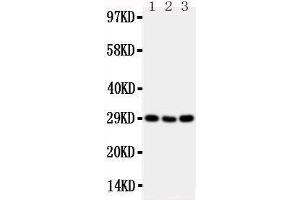 Anti-CD134/OX40 antibody,  Western blotting Lane 1: Mouse Brain Tissue Lysate Lane 2: Mouse Spleen Tissue Lysate Lane 3: Mouse Liver Tissue Lysate (TNFRSF4 Antikörper  (N-Term))