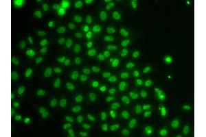 Immunofluorescence analysis of U20S cell using TOX antibody.