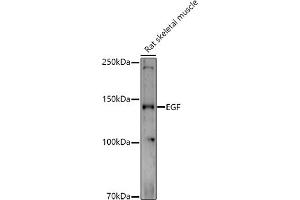 Western blot analysis of extracts of Rat skeletal muscle, using EGF antibody (ABIN6133981, ABIN6139971, ABIN6139973 and ABIN6217680) at 1:1000 dilution. (EGF Antikörper  (AA 850-950))
