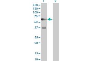 Western Blot analysis of PFKFB3 expression in transfected 293T cell line by PFKFB3 monoclonal antibody (M08), clone 3F3. (PFKFB3 Antikörper  (AA 412-520))