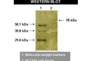 Western Blotting (WB) image for anti-RYK Receptor-Like Tyrosine Kinase (RYK) antibody (ABIN264516) (RYK Antikörper)