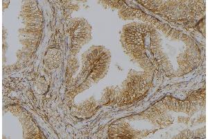 ABIN6278110 at 1/100 staining Mouse colon tissue by IHC-P.