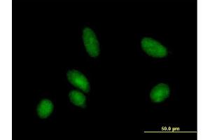 Immunofluorescence of purified MaxPab antibody to CDA on HeLa cell. (CDA Antikörper  (AA 1-146))