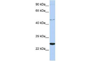 WB Suggested Anti-CRLF1 Antibody Titration:  0. (CRLF1 Antikörper  (Middle Region))