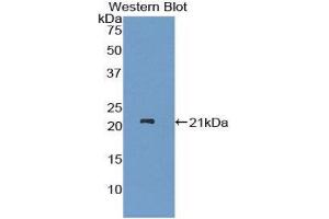 Western Blotting (WB) image for anti-ADAM Metallopeptidase with thrombospondin Type 1 Motif, 12 (ADAMTS12) (AA 823-997) antibody (ABIN1857900) (ADAMTS12 Antikörper  (AA 823-997))