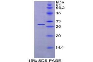 SDS-PAGE analysis of Mouse PTPRS Protein.
