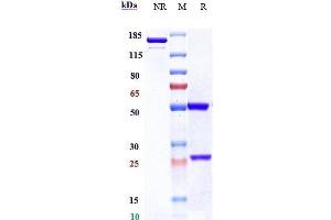 Anti-TNFRSF8 / CD30 Reference Antibody (brentuximab) on SDS-PAGE under reducing (R) condition. (Rekombinanter TNFRSF8 (Brentuximab Biosimilar) Antikörper)