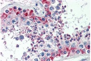 Human Testis (formalin-fixed, paraffin-embedded) stained with MAS1 antibody ABIN462250 followed by biotinylated goat anti-rabbit IgG secondary antibody ABIN481713, alkaline phosphatase-streptavidin and chromogen. (MAS1 Antikörper  (AA 187-236))