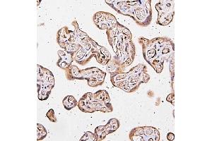 IHC analysis of CARS using anti-CARS antibody (ABIN5692995).