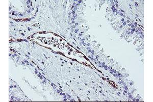 Image no. 2 for anti-Dystrobrevin, beta (DTNB) antibody (ABIN1497914) (Dystrobrevin beta Antikörper)
