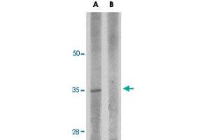 Western blot analysis of RWDD3 in rat kidney tissue lysate with RWDD3 polyclonal antibody  at 1 ug/mL in (A) the absence and (B) the presence of blocking peptide. (RWDD3 Antikörper  (C-Term))