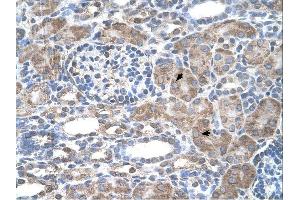 IFI44L antibody was used for immunohistochemistry at a concentration of 4-8 ug/ml. (IFI44L Antikörper  (N-Term))