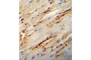 COL5A1 antibody immunohistochemistry analysis in formalin fixed and paraffin embedded mouse heart tissue followed by peroxidase conjugation of the secondary antibody and DAB staining. (COL5A1 Antikörper  (N-Term))