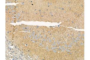 ABIN6265703 and ABIN6268929 at 1/100 staining Rat brain tissue by IHC-P. (TRAF2 Antikörper  (C-Term))