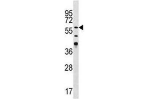 Western blot analysis of CAMK2G antibody in Jurkat lysate (CAMKII gamma Antikörper  (AA 309-338))