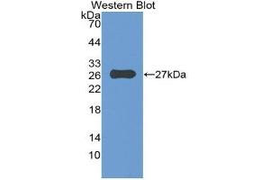 Western blot analysis of the recombinant protein. (Reelin Antikörper  (AA 2086-2296))