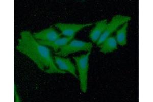 ICC/IF analysis of GSR in HeLa cells line, stained with DAPI (Blue) for nucleus staining and monoclonal anti-human GSR antibody (1:100) with goat anti-mouse IgG-Alexa fluor 488 conjugate (Green). (Glutathione Reductase Antikörper  (AA 43-522))