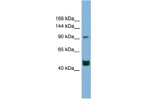 WB Suggested Anti-MAML3 Antibody Titration:  0. (MAML3 Antikörper  (Middle Region))