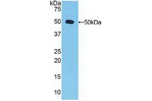 Western blot analysis of recombinant Human DVL3. (DVL3 Antikörper  (AA 545-716))