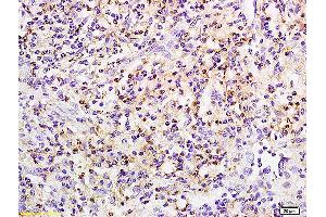 Formalin-fixed and paraffin embedded rat small intestine labeled with Anti phospho-PRKCB(Ser642) Polyclonal Antibody, Unconjugated (ABIN711461) at 1:200 followed by conjugation to the secondary antibody and DAB staining (Pkc beta 1 Antikörper  (pSer642))