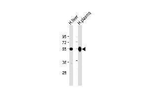 Western Blot at 1:2000 dilution Lane 1: human liver lysate Lane 2: human plasma lysate Lysates/proteins at 20 ug per lane. (Gc (AA 442-473) Antikörper)