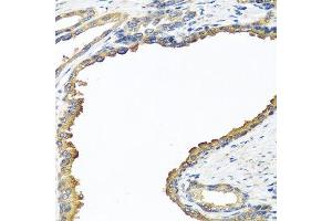 Immunohistochemistry of paraffin-embedded human prostate using NYX antibody. (Nyctalopin Antikörper  (AA 282-481))