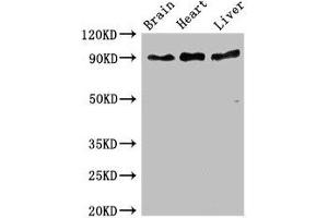 Western Blot Positive WB detected in: Mouse brain tissue, Rat heart tissue, Rat liver tissue All lanes: RPS6KA5 antibody at 3 μg/mL Secondary Goat polyclonal to rabbit IgG at 1/50000 dilution Predicted band size: 90, 62, 82 kDa Observed band size: 90 kDa (MSK1 Antikörper  (AA 224-367))