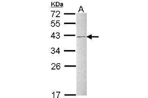 WB Image Sample (30 ug of whole cell lysate) A: Raji 12% SDS PAGE antibody diluted at 1:1000 (HNRNPC Antikörper)