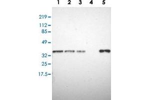 Western blot analysis of Lane 1: RT-4, Lane 2: U-251 MG, Lane 3: A-431, Lane 4: Liver, Lane 5: Tonsil with STX7 polyclonal antibody  at 1:250-1:500 dilution. (Syntaxin 7 Antikörper)