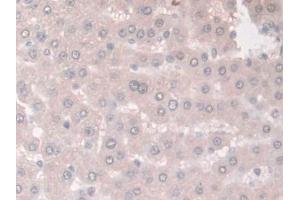 Detection of ADIPOR2 in Rat Liver Tissue using Polyclonal Antibody to Adiponectin Receptor 2 (ADIPOR2)