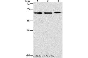 Western blot analysis of PC3, Jurkat and Raji cell, using APOBEC3G Polyclonal Antibody at dilution of 1:240