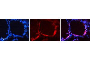 Immunohistochemistry (IHC) image for anti-Cadherin 1, Type 1, E-Cadherin (Epithelial) (CDH1) (Middle Region) antibody (ABIN2784498)