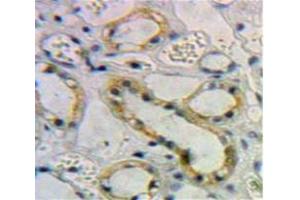 Used in DAB staining on fromalin fixed paraffin-embedded Kidney tissue (Activin A Receptor Type IB/ALK-4 Antikörper  (AA 24-126))