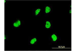 Immunofluorescence of monoclonal antibody to DAZAP1 on HeLa cell.