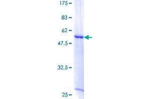 XRCC6BP1 Protein (AA 1-246) (GST tag)