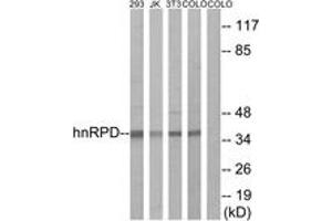 Western blot analysis of extracts from 293/Jurkat/3T3/COLO205 cells, using hnRPD (Ab-83) Antibody. (HNRNPD/AUF1 Antikörper  (AA 49-98))