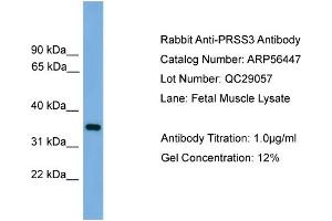 WB Suggested Anti-PRSS3  Antibody Titration: 0. (PRSS3 Antikörper  (N-Term))