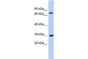 WB Suggested Anti-AKTIP Antibody Titration: 0. (AKTIP Antikörper  (Middle Region))