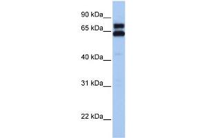 WB Suggested Anti-HSPD1 Antibody Titration:  0. (HSPD1 Antikörper  (C-Term))