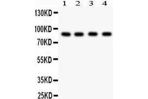 Western Blotting (WB) image for anti-Furin (Paired Basic Amino Acid Cleaving Enzyme) (FURIN) (AA 591-794) antibody (ABIN3042409) (FURIN Antikörper  (AA 591-794))