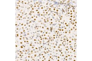 Immunohistochemistry of paraffin-embedded rat ovary using TCE Rabbit mAb (ABIN7270877) at dilution of 1:25 (40x lens). (TCEA1 Antikörper)